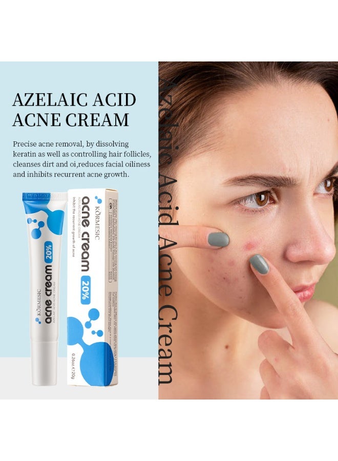 Kormesic 20% كريم حمض الزوليك للبثور كريم حمض الزوليك للوجه عالي الجودة، تجميل، يمنع الانتفاخات، يخفف البثور، يوضح البشرة، يهدئ التهيج - Image 2